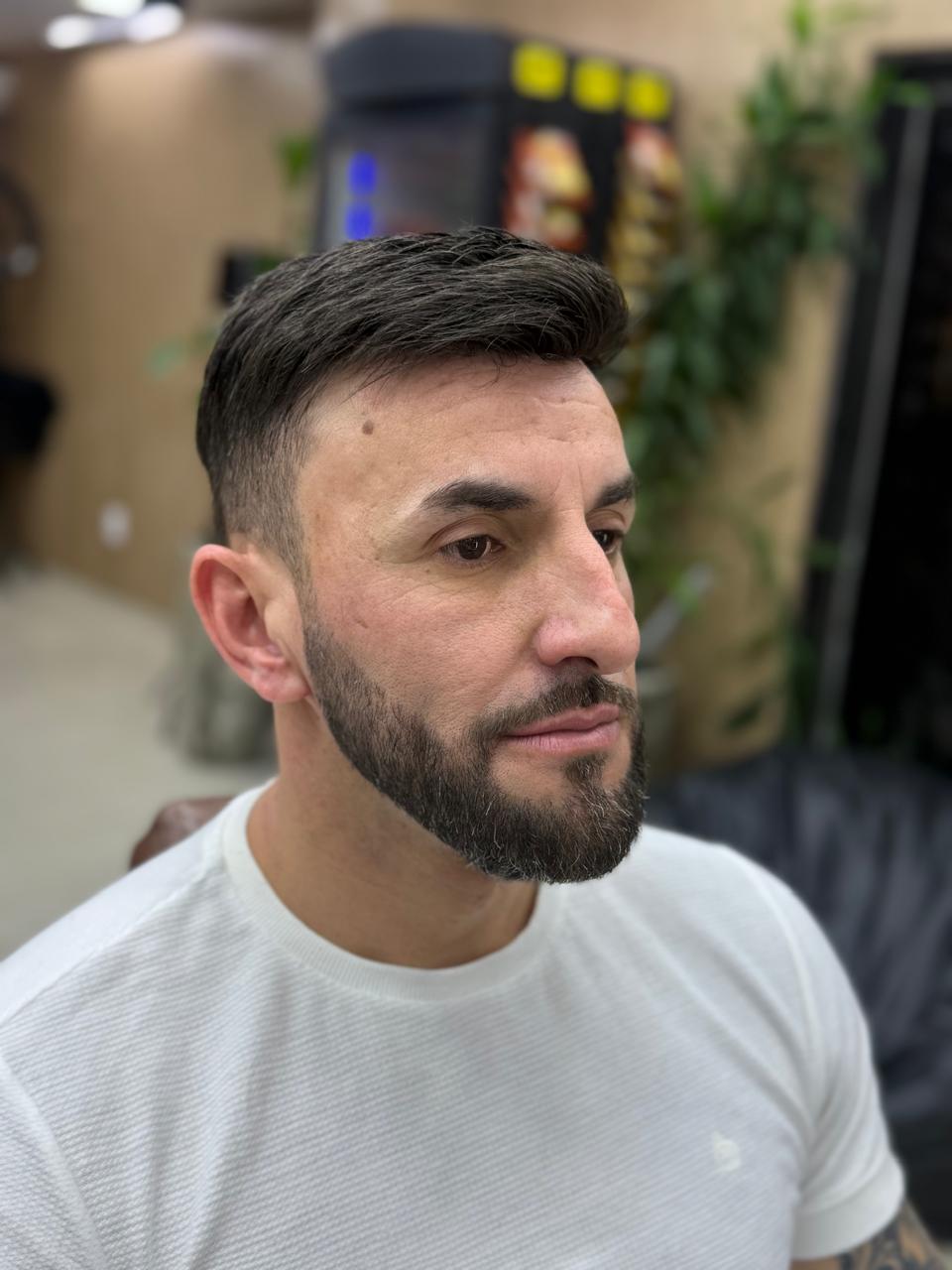 Aplicação de prótese capilar na Cadillac — resultado imediato