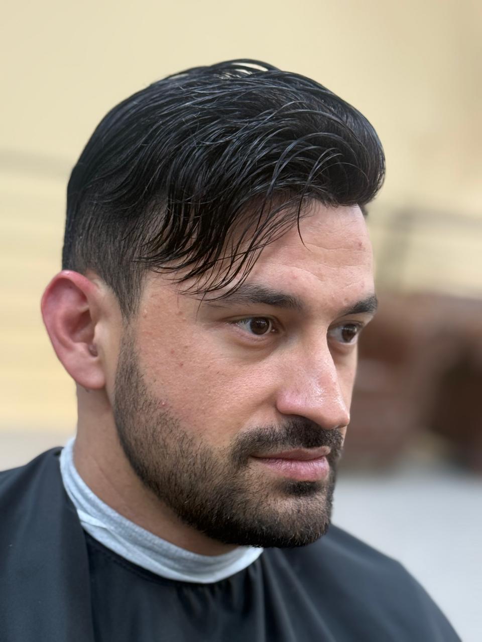 Resultado real de prótese capilar — unidade de Novo Hamburgo