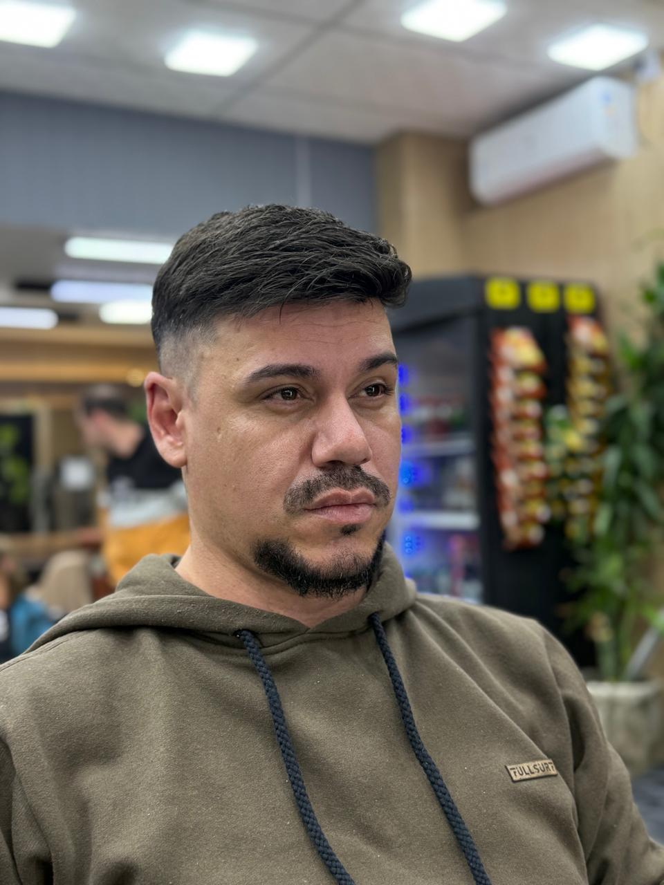 Prótese capilar masculina aplicada — visual natural e discreto